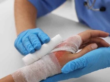 What Compensation Can You Recover After a Fire Injury?