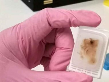 Exploring the Vital Role of FFPE Tissue Blocks in Diagnostics