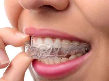 How Same Day Orthodontic Treatment Is Changing Smiles in Surrey