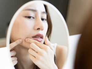 How to Prevent Clogged Pores in Humid Weather