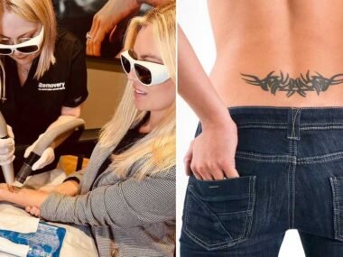The New Trend to Erase