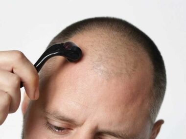 How Microneedling Can Help Regrow Your Hair Naturally   