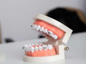 Ways-to-Protect-Your-Teeth-From-Damage