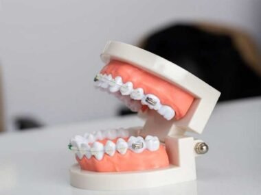 Ways-to-Protect-Your-Teeth-From-Damage