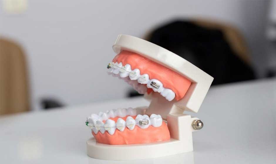 Ways-to-Protect-Your-Teeth-From-Damage