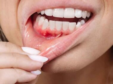 How Downtown’s Dentists Treat Gums with Expert Periodontal Care