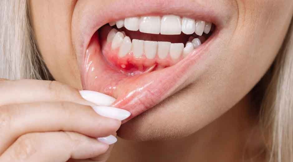 How Downtown’s Dentists Treat Gums with Expert Periodontal Care