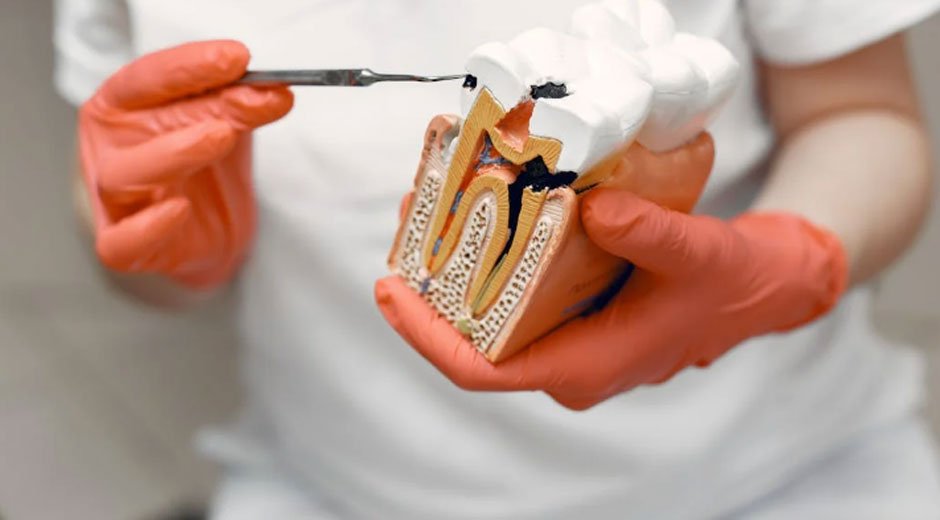 How Root Canal Therapy Saves Your Natural Teeth Effectively