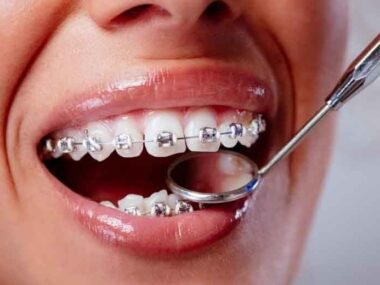 What Orthodontists in Las Vegas Do To Make Care Feel Personal