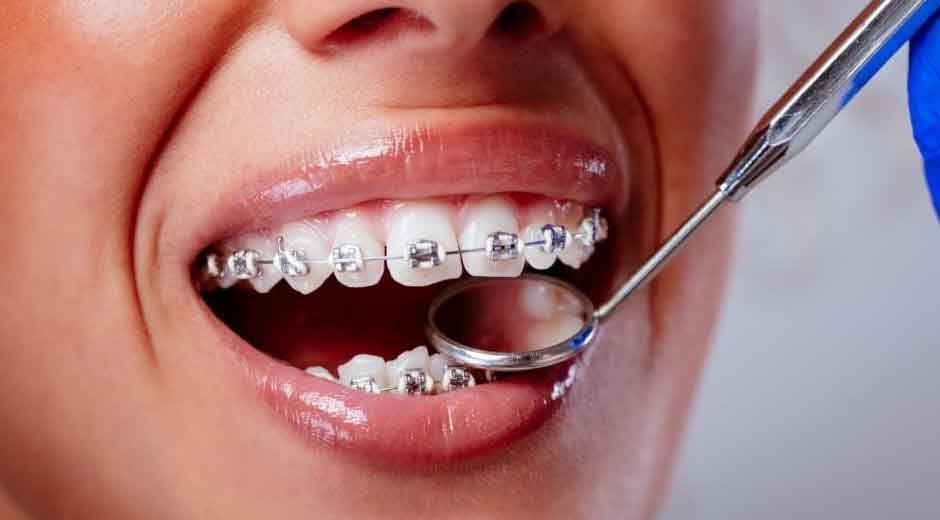 What Orthodontists in Las Vegas Do To Make Care Feel Personal