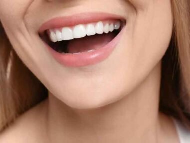 Key Facts About Veneers Every Patient Around Peabody Should Understand