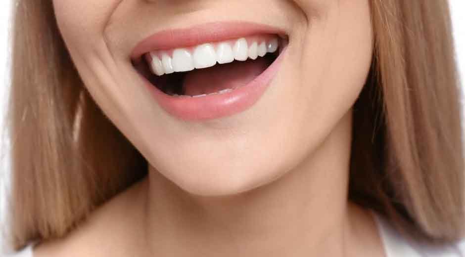 Key Facts About Veneers Every Patient Around Peabody Should Understand