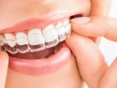 The Invisible Way to Get the Smile You've Always Wanted