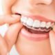Discover How Effective Invisalign Truly Is With Expert Orthodontists in Kelowna