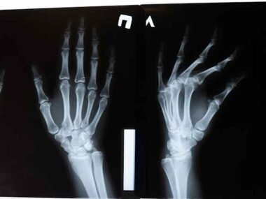 Predictive-Analytics-in-Radiology