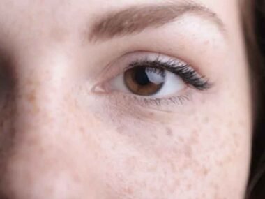 Why-Some-Skin-Concerns-Need-More-Than-Facials-and-Products