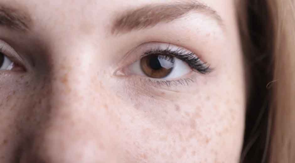 Why-Some-Skin-Concerns-Need-More-Than-Facials-and-Products